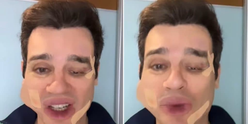 "Cuidado", Celso Portiolli surge com rosto todo deformado em vídeo, expõe surra e motivo: "Nunca esqueça"