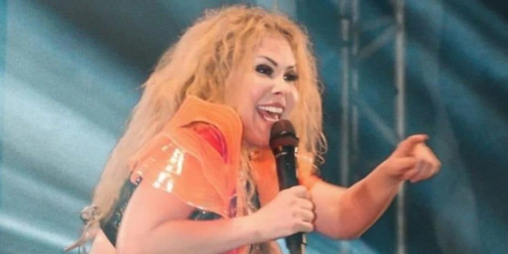 Joelma, ainda com rosto inchado, passa mal em show e assessoria se pronuncia
