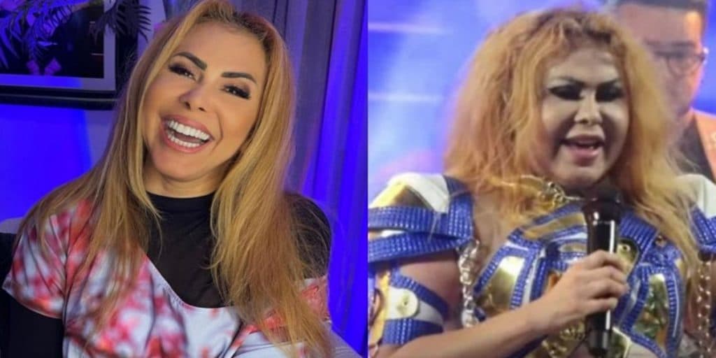 Após surgir com rosto deformado, Joelma tem notícia bomba sobre saúde divulgada e causa tristeza: "Sequela"