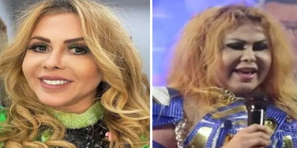 Internada às pressas, Joelma tem novo boletim médico divulgado e real estado de saúde choca: "Tratamento"