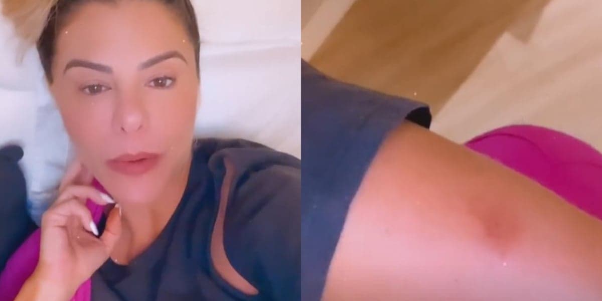 Poliana Rocha fala que quase teve o braço amputado - Foto: Reprodução
