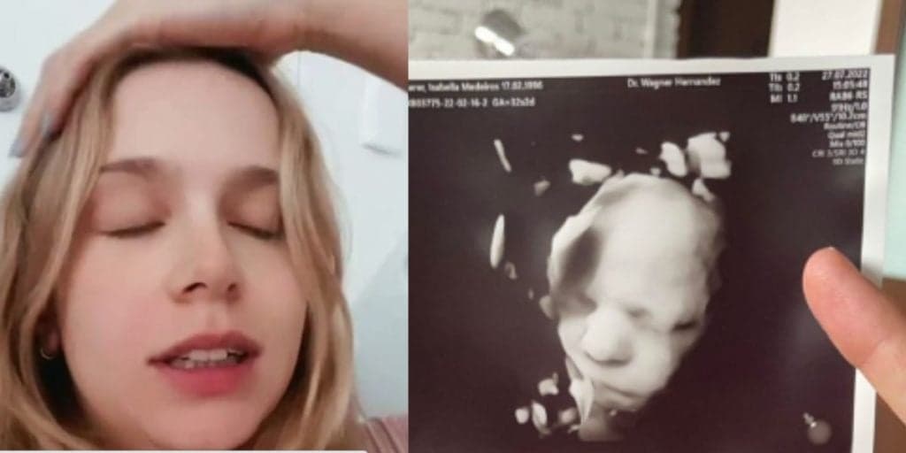 Grávida pela 1º vez, filha de Xuxa é internada às pressas em hospital e estado de saúde é divulgado em boletim