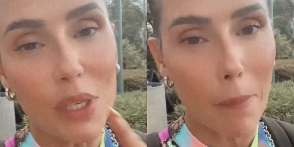 Deborah Secco faz procedimento no rosto, sofre resultado horrível e atriz se arrepende: "Fiquei um alien"
