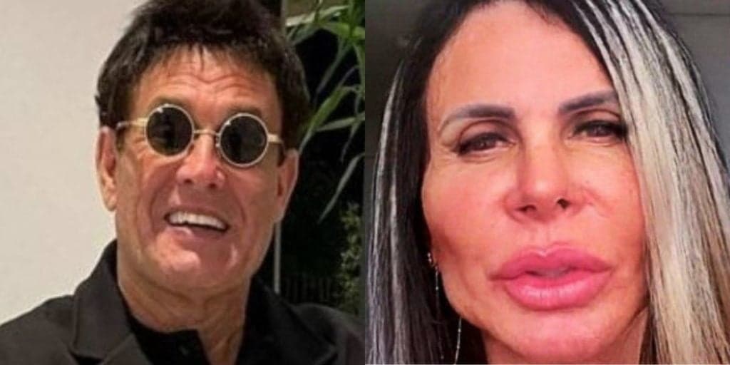 Sérgio Mallandro fica idêntico a Gretchen, segundo internautas, após procedimento no rosto e surge irreconhecível