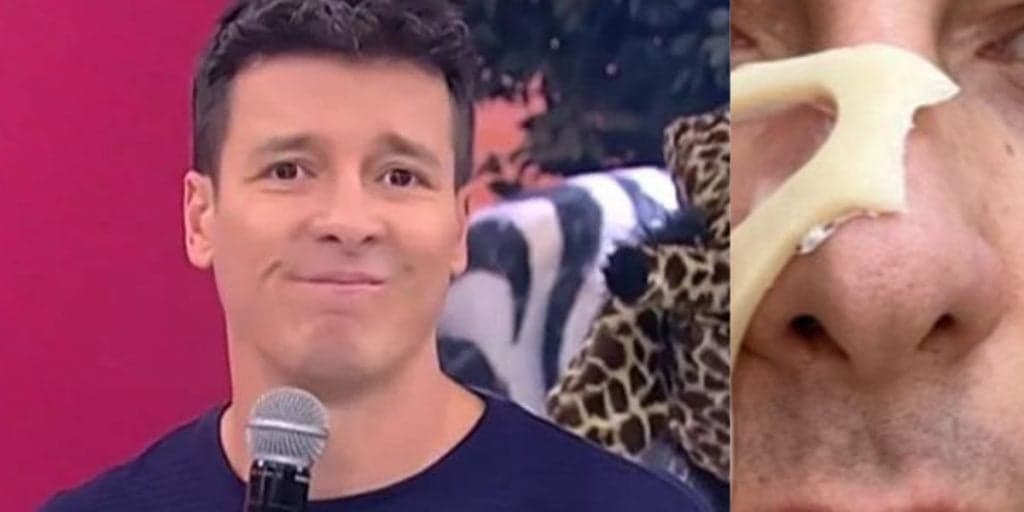 Rodrigo Faro tem rosto 'desfigurado' e foto agonizante mostra pele se desbotando da cara do apresentador