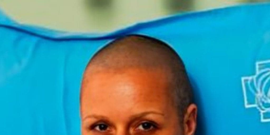 Atriz do 1º Pantanal ficou careca para papel em nova trama