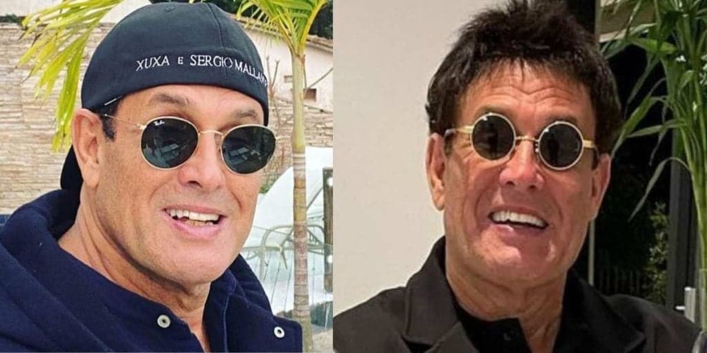 Sérgio Mallandro aparece em público com rosto desconfigurado e comenta sobre cirurgia: "Exigiram"