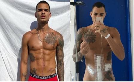 Jonas Piazon antes e depois de ser esfaqueado (Imagem: Montagem)