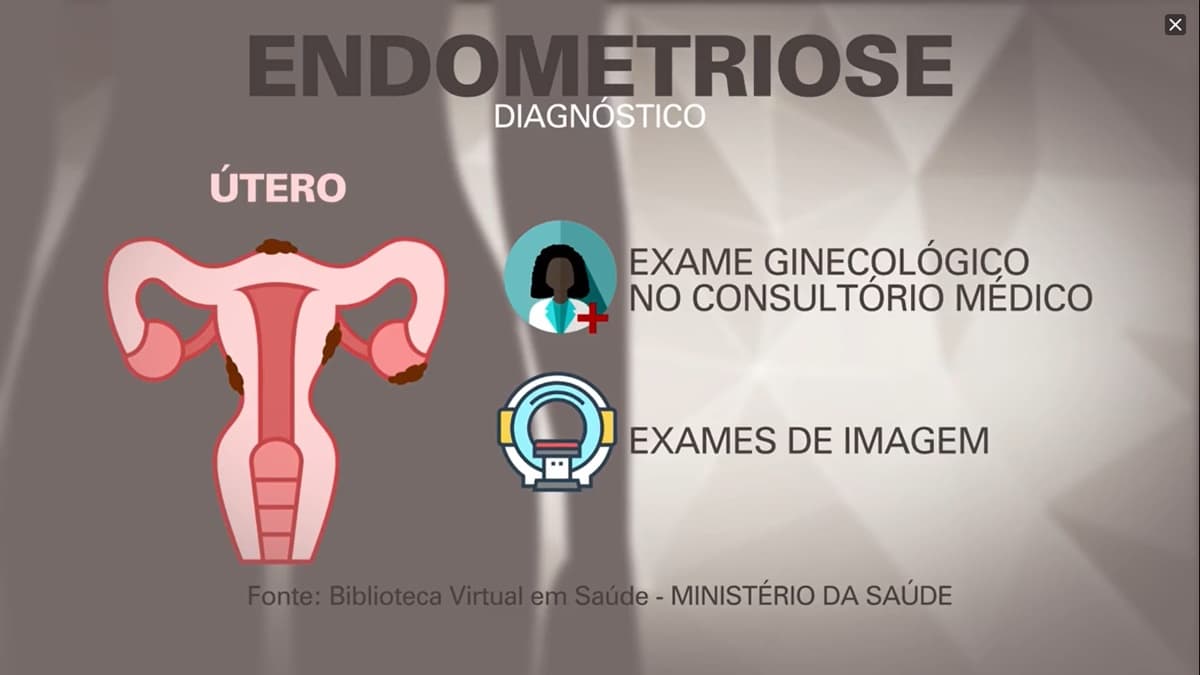 "Fantástico" explica doença de Anitta e alerta mulheres "Fantástico" explica doença de Anitta e alerta mulheres