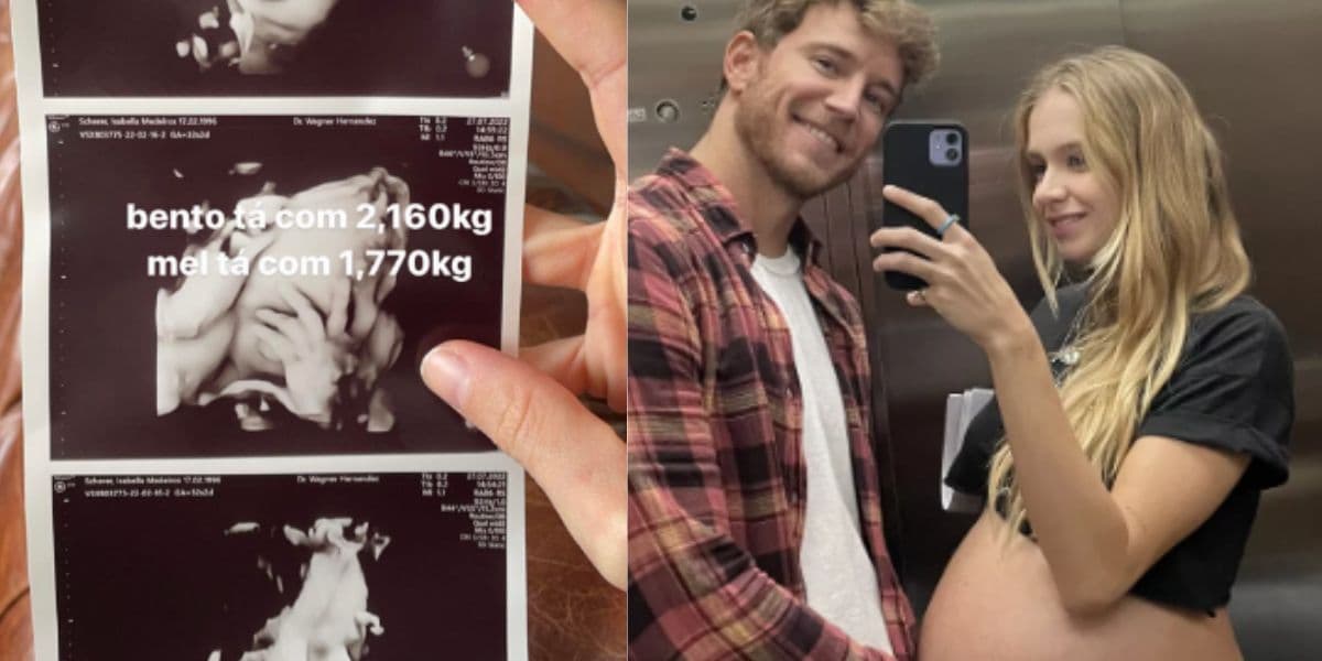 Filha de Xuxa passa por cuidados médicos após ida às pressas em hospital