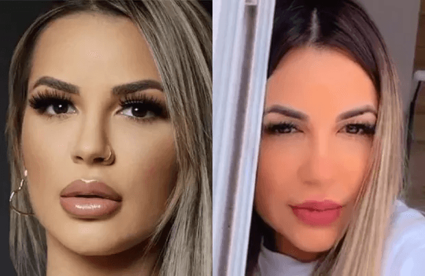 Deolane Bezerra retirou o preenchimento labial (Foto: Reprodução)