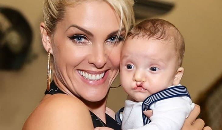Ana Hickmann em foto com o sobrinho com lábios leopoldino (Foto: Reprodução) Ana Hickmann em foto com o sobrinho com lábios leopoldino (Foto: Reprodução)