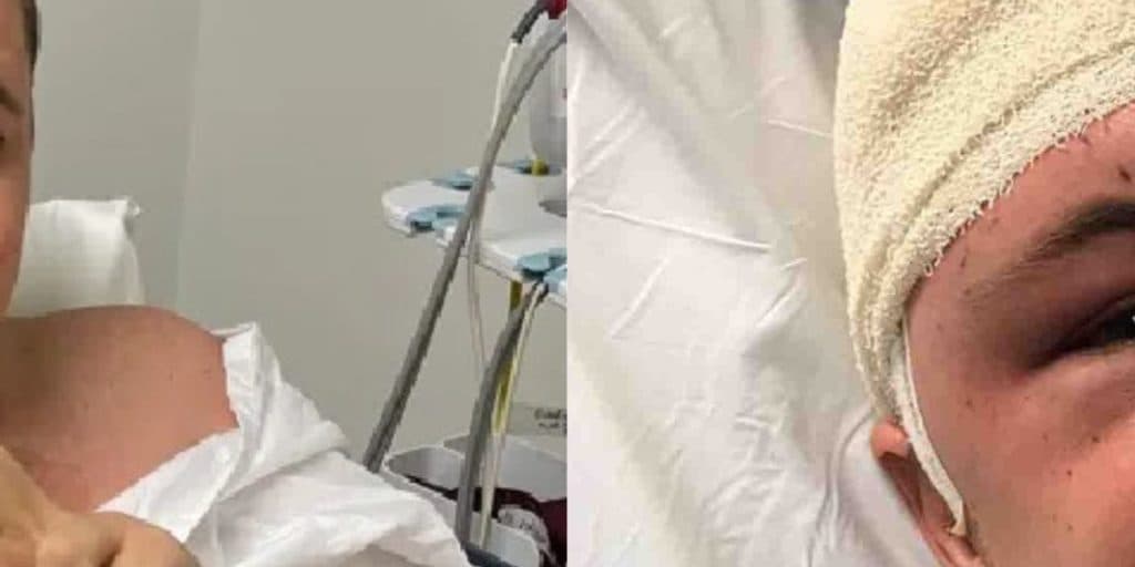 Ator, com câncer no cérebro, se irrita com diagnóstico e faz duro desabafo: "A positividade não cura"