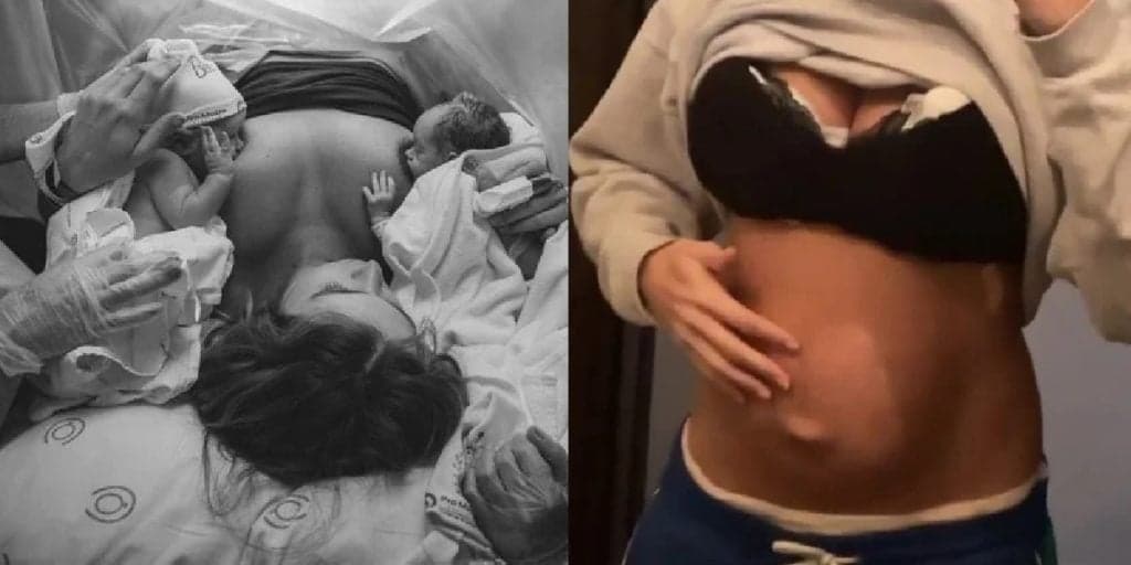 Filha de Xuxa, que acabou de dar à luz, expõe situação após cirurgia: “Não sei se volta”