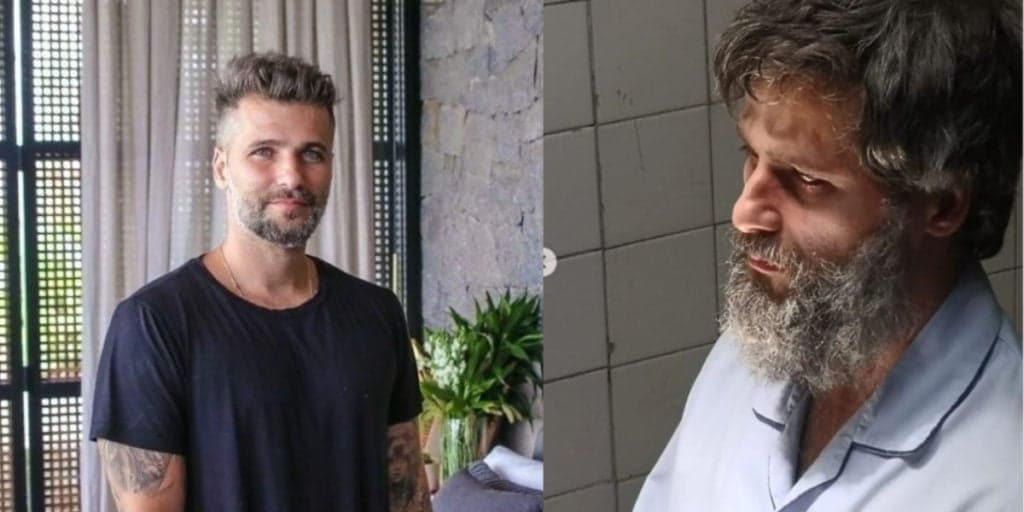Bruno Gagliasso surge 'envelhecido e machucado' em fotos e assusta: "Não dormem mais"