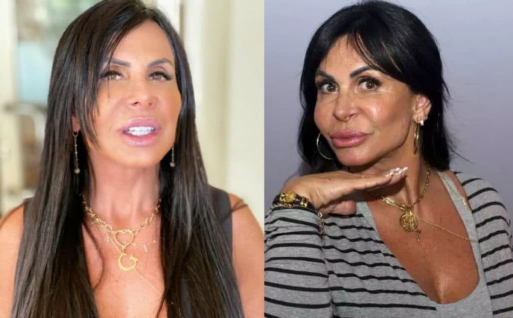 Gretchen revela novas plásticas
