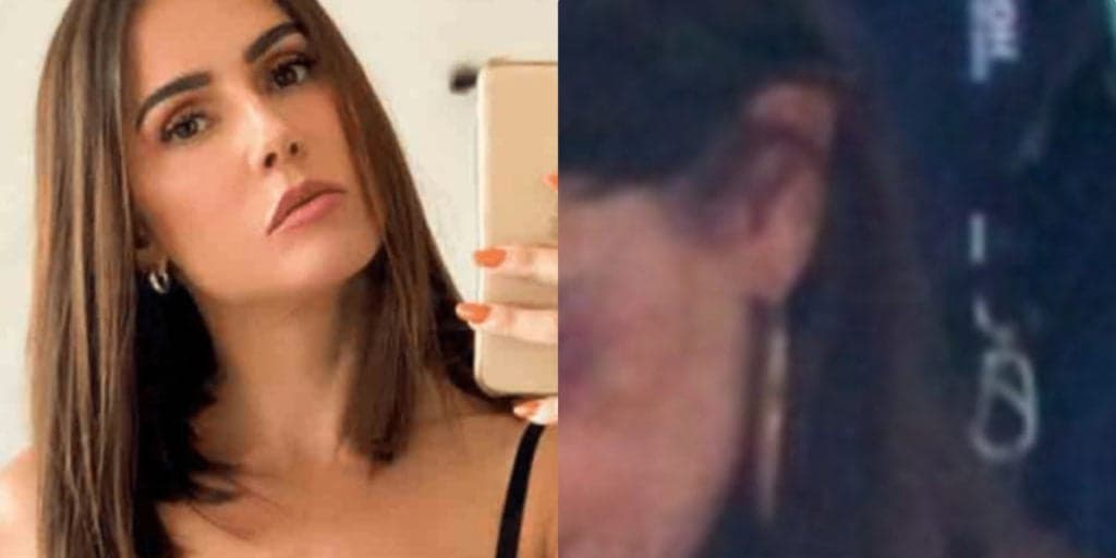 Olho roxo e hematomas: Deborah Secco é flagrada com marcas no rosto deixando hotel de luxo