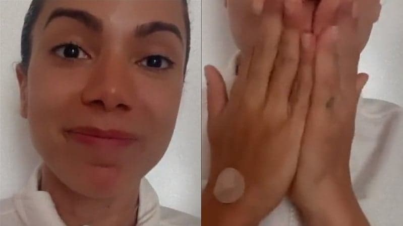 Anitta surge abatida em suas redes sociais, com curativos aparentes e deixa fãs preocupados  - Foto Reprodução