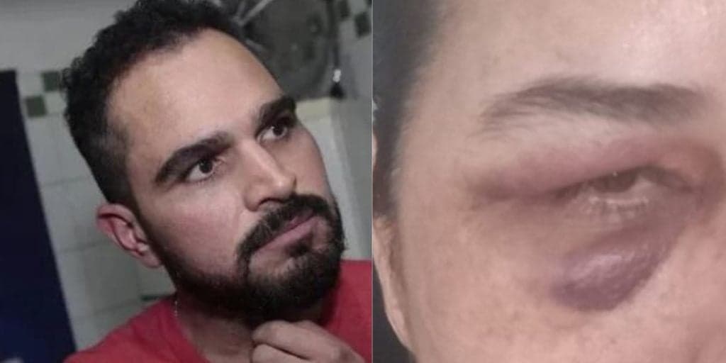 Ex de Luciano Camargo é espancada com capacete e presa durante briga generalizada: ‘Posso ficar cega’