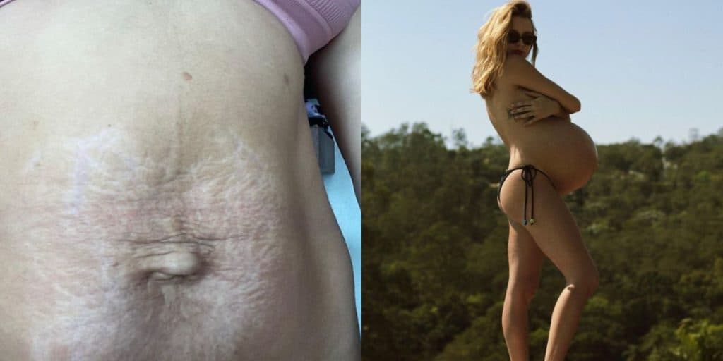 Isa Scherer mostra barriga após nascimento dos gêmeos, perde 16kg e desabafa: "Zero perto do corpo que gosto"