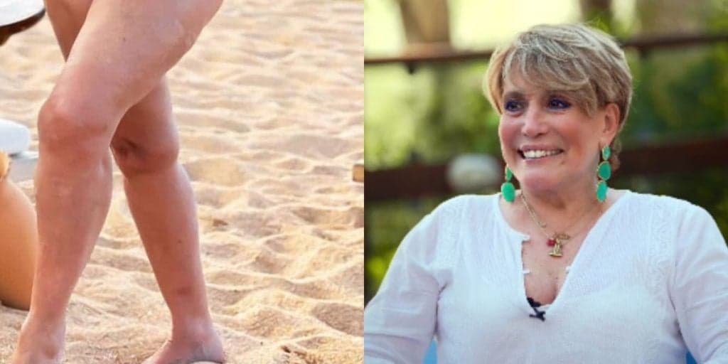Susana Vieira provoca em vídeo, sobe o vestido e prova que deixa muita novinha no chinelo aos 80 anos