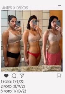 Jéssica Beatriz em foto do Instagram; filha de Leonardo mostrou detalhes do antes e depois (Foto: Reprodução / Instagram) Jéssica Beatriz em foto do Instagram; filha de Leonardo mostrou detalhes do antes e depois (Foto: Reprodução / Instagram)