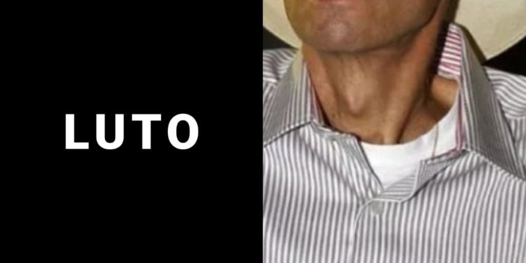 Famoso cantor descobriu câncer terminal, ficou com a boca torta e impactou ao suplicar: "Não aguento mais sofrer"