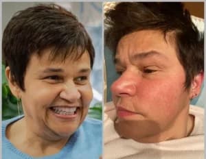 Manchas de Claudia Rodrigues deixaram os médicos preocupados (Foto: Reprodução)