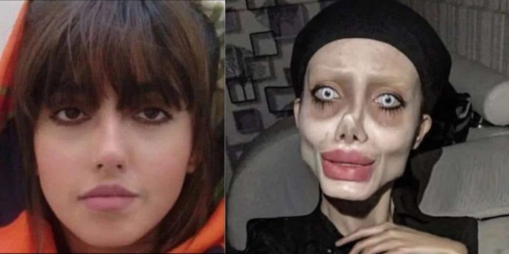 Esta famosa passou por mais de 50 plásticas, foi presa, apelidada de "zumbi" e resolveu desaparecer