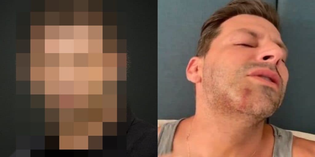 Como está o ator Henri Castelli hoje, após ficar com o rosto deformado e ser brutalmente espancado