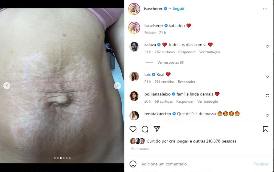 Isa Scherer, filha do nadador Xuxa, mostra barriga real um mês após o parto dos gêmeos - Foto: Reprodução
