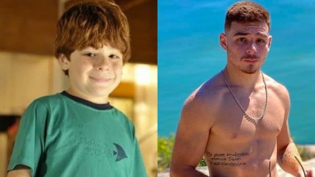 Ex-ator mirim de 'A Vida de Gente' renasceu após grave acidente: "112 pontos no rosto e perna quebrada"