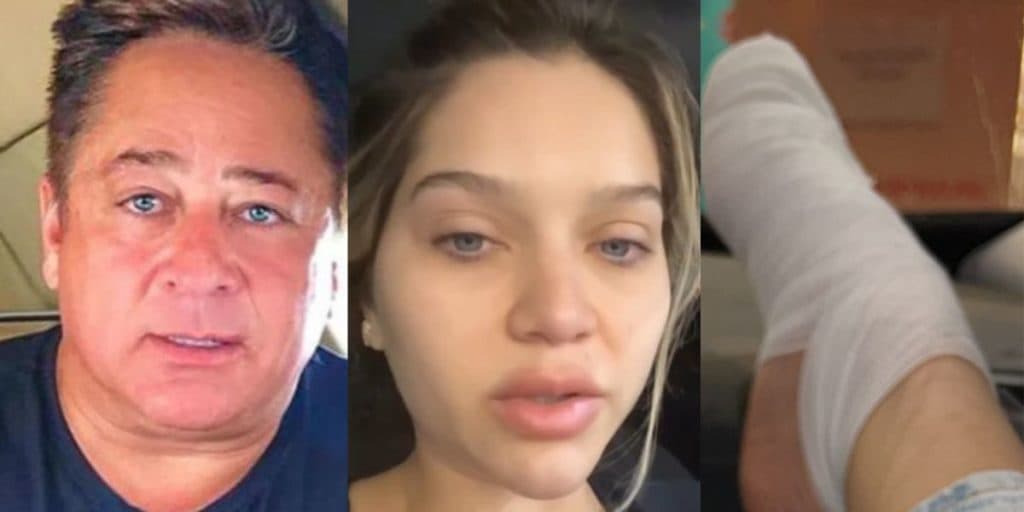 Filha de Leandro, sobrinha de Leonardo, sofre acidente e surge com fratura: 'Desesperada"