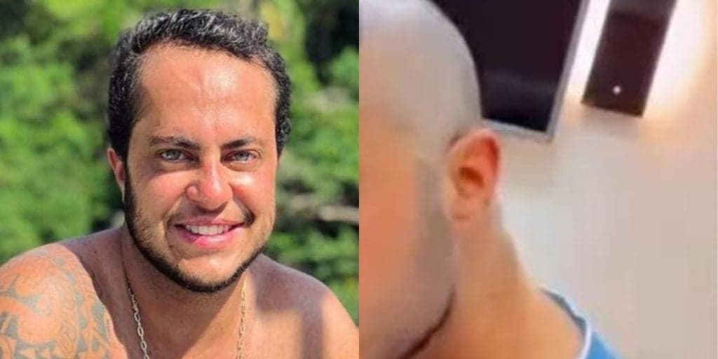 Thammy Miranda surge careca, com aparência diferente e confessa o que aconteceu ao público: "Transplante"