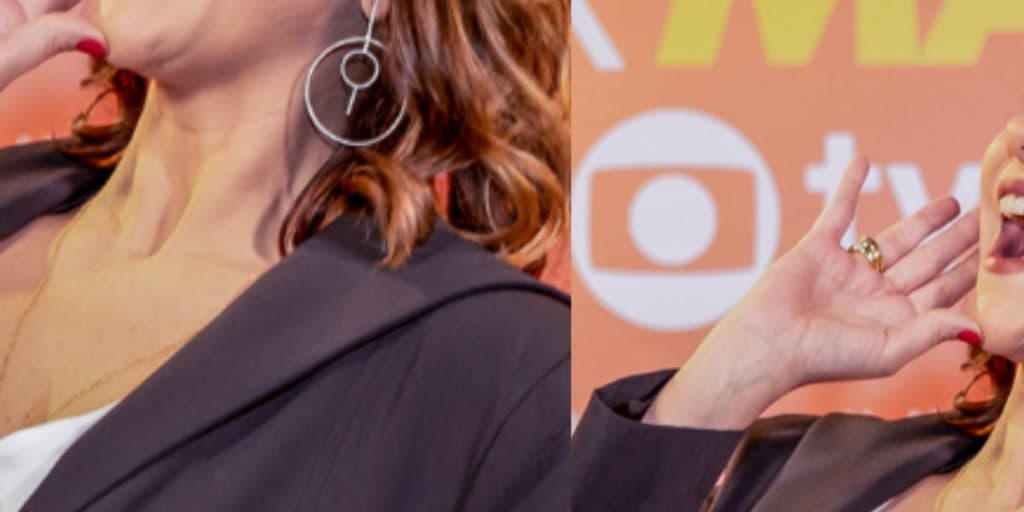 Cirurgia de apresentadora da Globo deu errado e ela desabafou sobre trauma: "Uma dobra"
