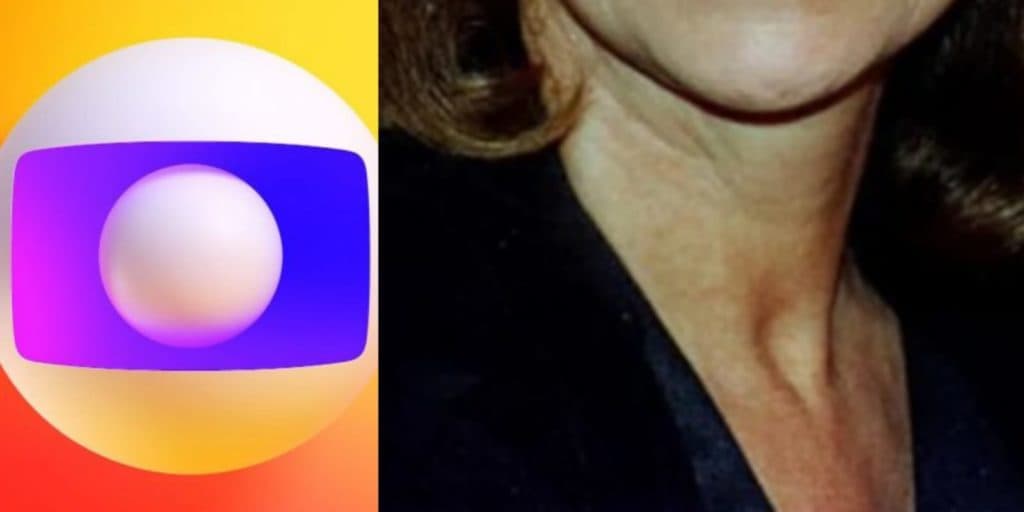Estrela da Globo e herdeira de milhões faliu, ficou sem ter onde morar e morreu sozinha em abrigo