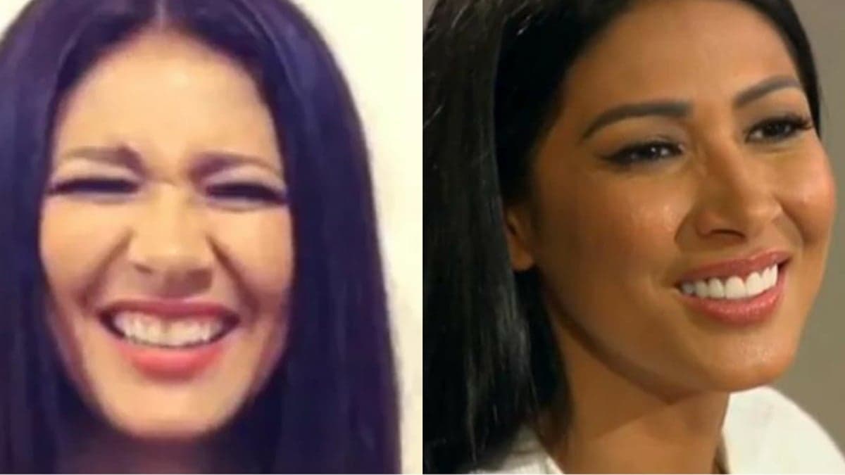 Simaria antes e depois das lentes nos dentes (Reprodução) Simaria antes e depois das lentes nos dentes (Reprodução)