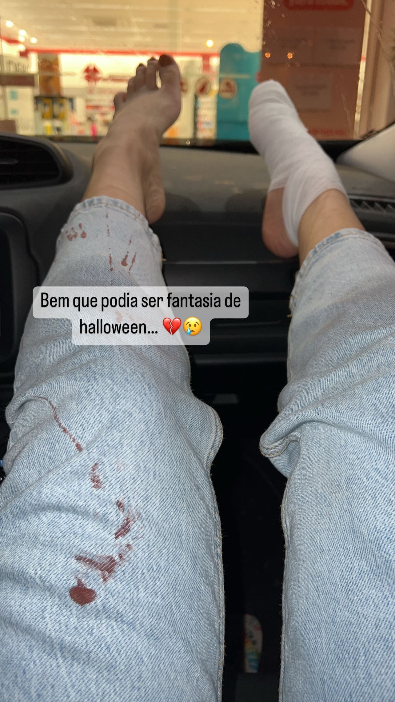 Sobrinha de Leonardo faz desabafo nas redes sociais após sofrer acidente  - Reprodução
