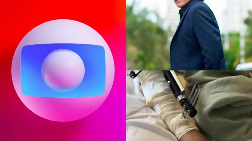 Ator que foi galã da Globo passou por 65 cirurgias e teve perna necrosada divulgada ao Brasil