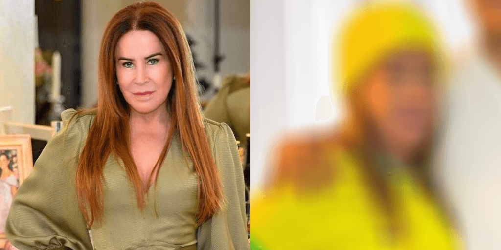 Zilu Godói surge com rosto deformado, expõe o que viveu e assume: "Me deixou inchada"