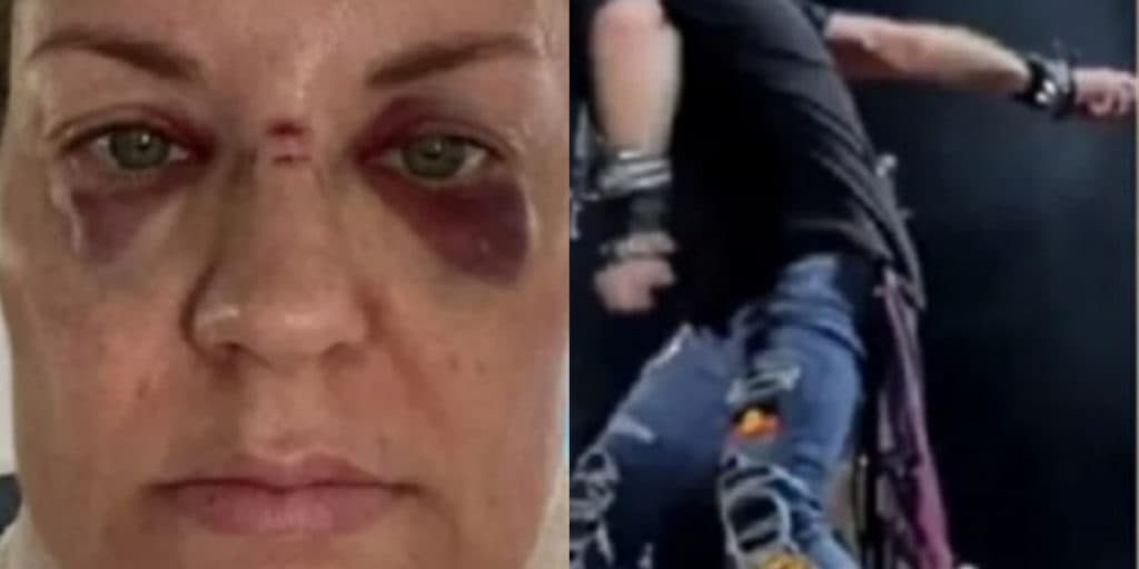 Famoso cantor arremessa microfone de cima do palco e atinge gravemente rosto de mulher: "Estava em choque"