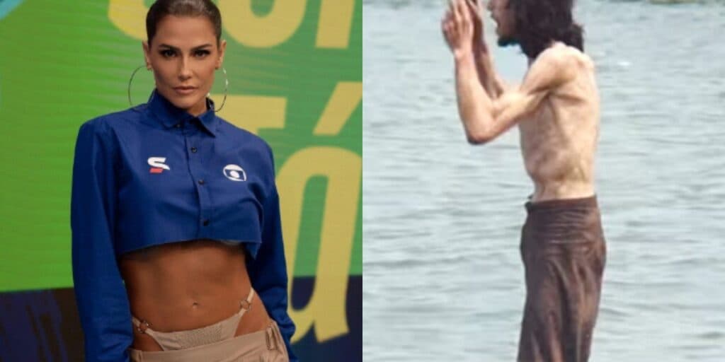 Deborah Secco e astro de Sob Pressão perderam peso para viverem personagens com Aids e esse foi o resultado