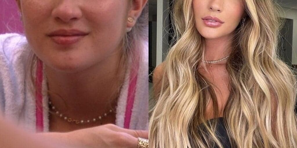 Musa do BBB descobriu câncer, lutou contra doença e hoje vive com paralisia: “Dias difíceis”