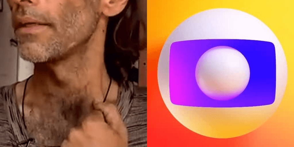 Ex-ator da Globo se afastou da TV, perdeu tudo e hoje é morador de rua: "As pessoas não são boas"