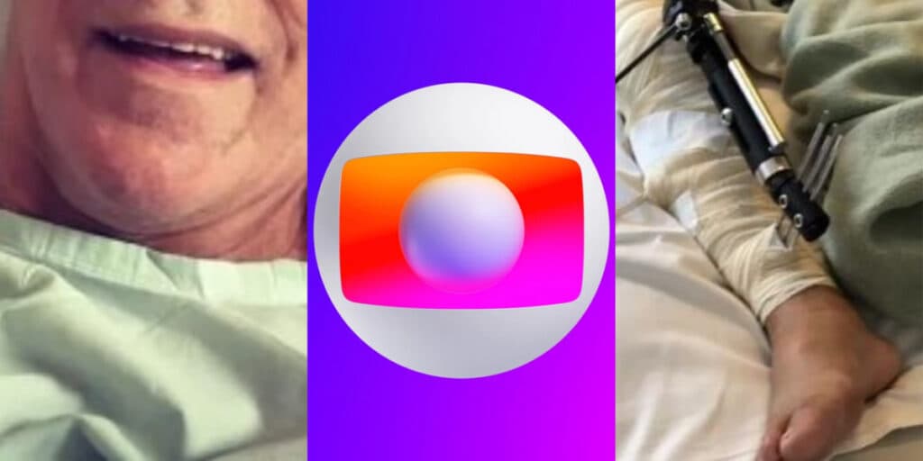 Galã da Globo sofreu grave acidente, ficou com perna necrosada e foi submetido a 65 cirurgias