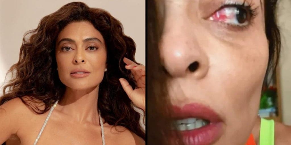 Juliana Paes surge em vídeo com o olho inchado e vermelho e causa preocupação em relato: "Não vou poder''
