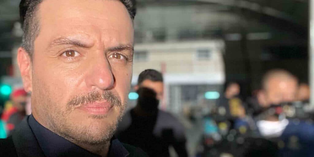 Rodrigo Lombardi surge todo arranhado, confessa motivo e até Thiago Fragoso se choca: "Gente"