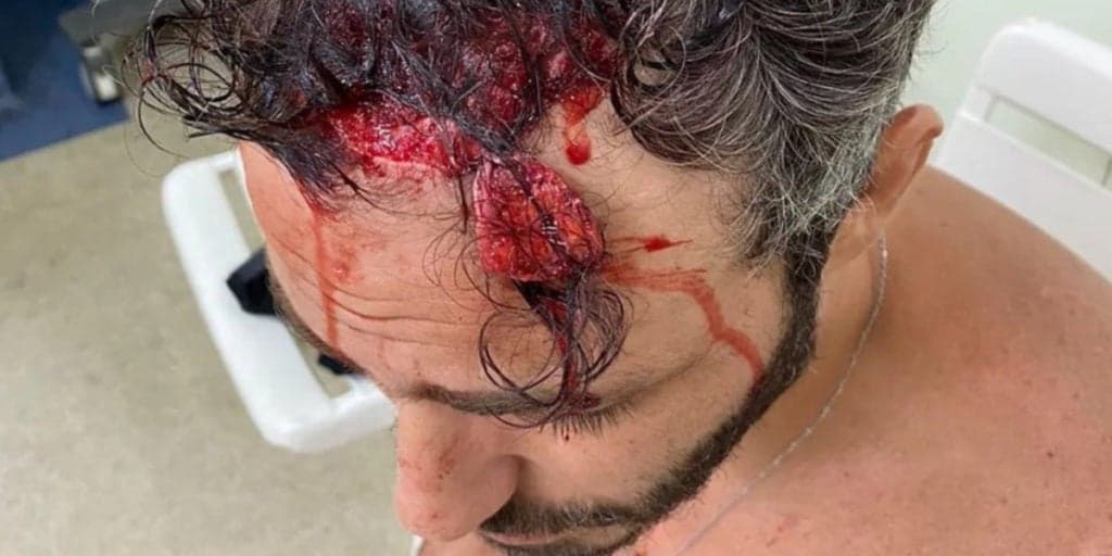 Thiago Rodrigues é encurralado por bandidos, espancado em praça pública e fica desacordado