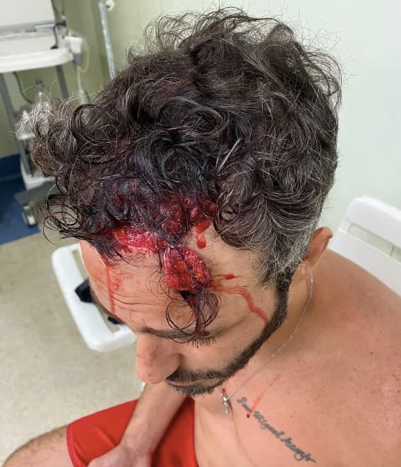 Thiago Rodrigues surgiu com o rosto completamente ensaguentado (Foto: Reprodução)