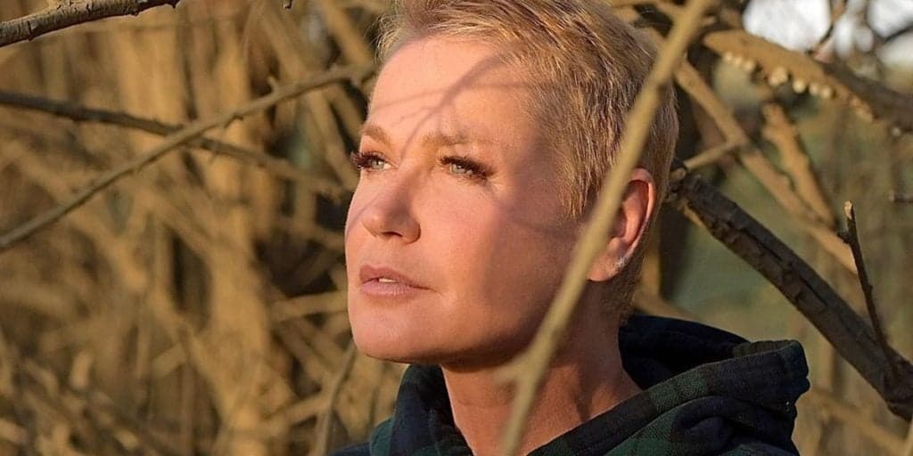 Xuxa Meneghel faz cirurgia estética e passa bem